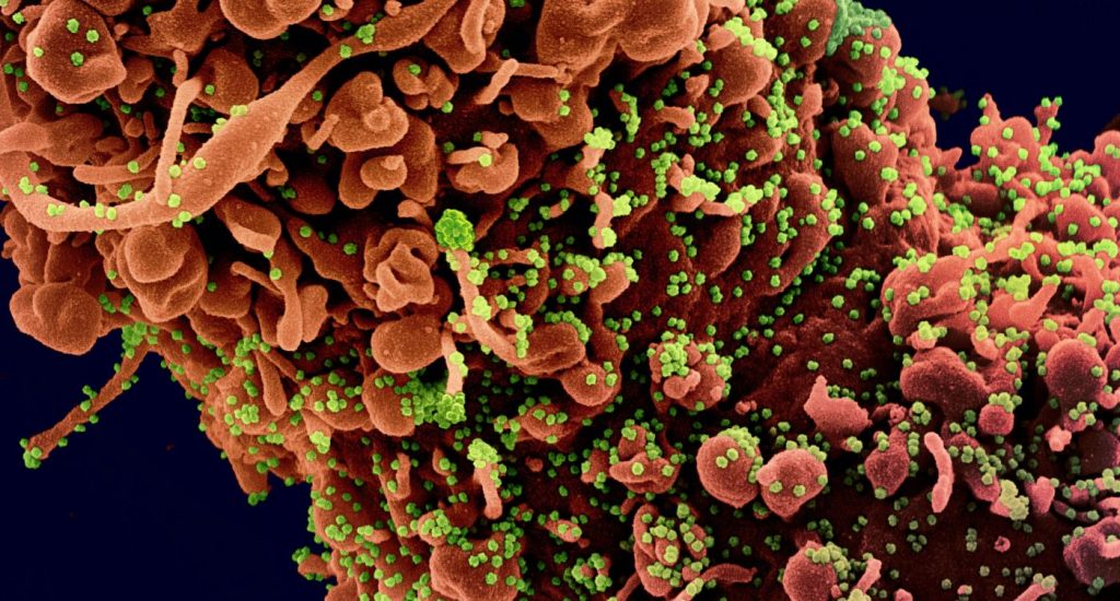 Virus Sars-CoV-2 en microscopio electrónico