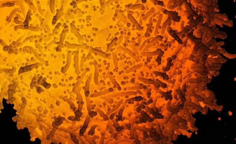 Virus que causa Covid-19 en microscopio