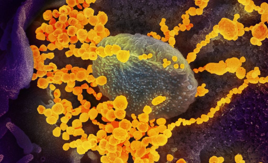 COVID-19 en microscopio