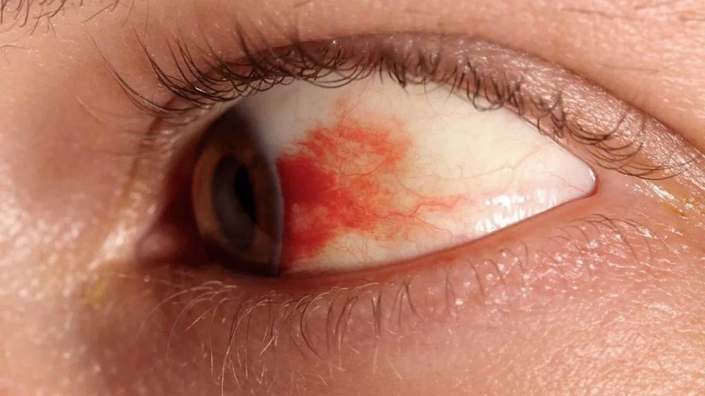 UNAM desarrolla gotas para prevenir pérdida de visión por diabetes